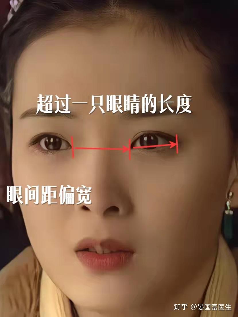 眼距宽是不是真的给人感觉就是对眼儿?