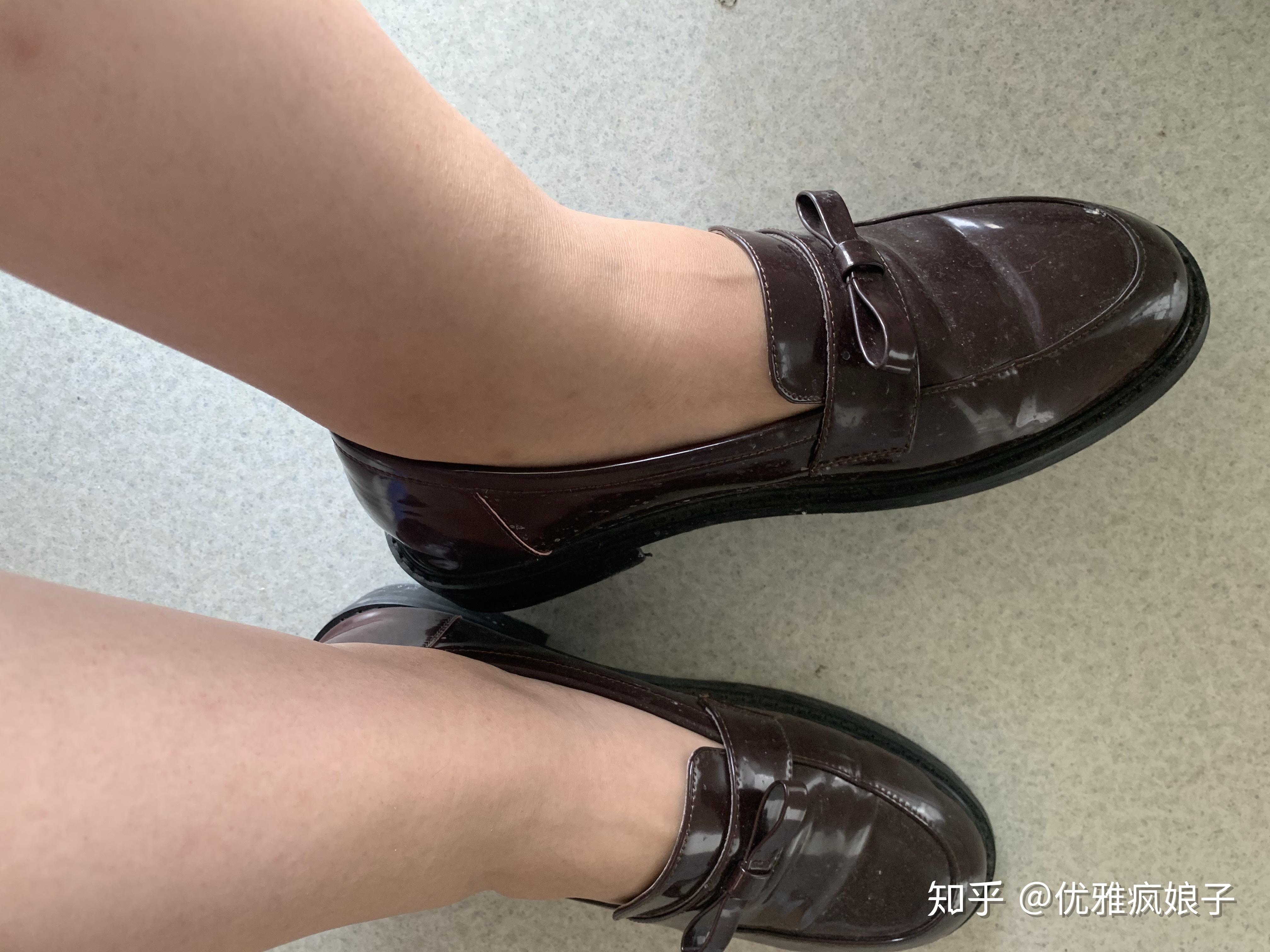 什么样的脚踝叫做没有脚踝? - 知乎