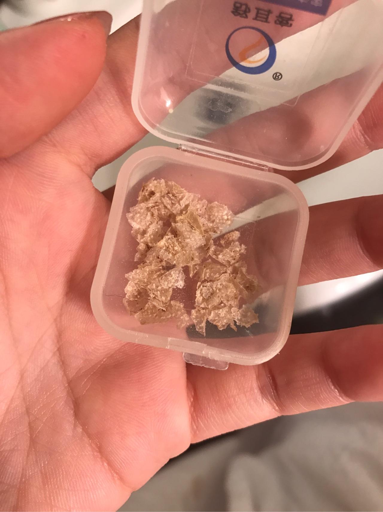 为什么抠下来大块的头皮屑会有瞬间的快感