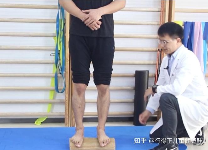 足外翻能矫正吗