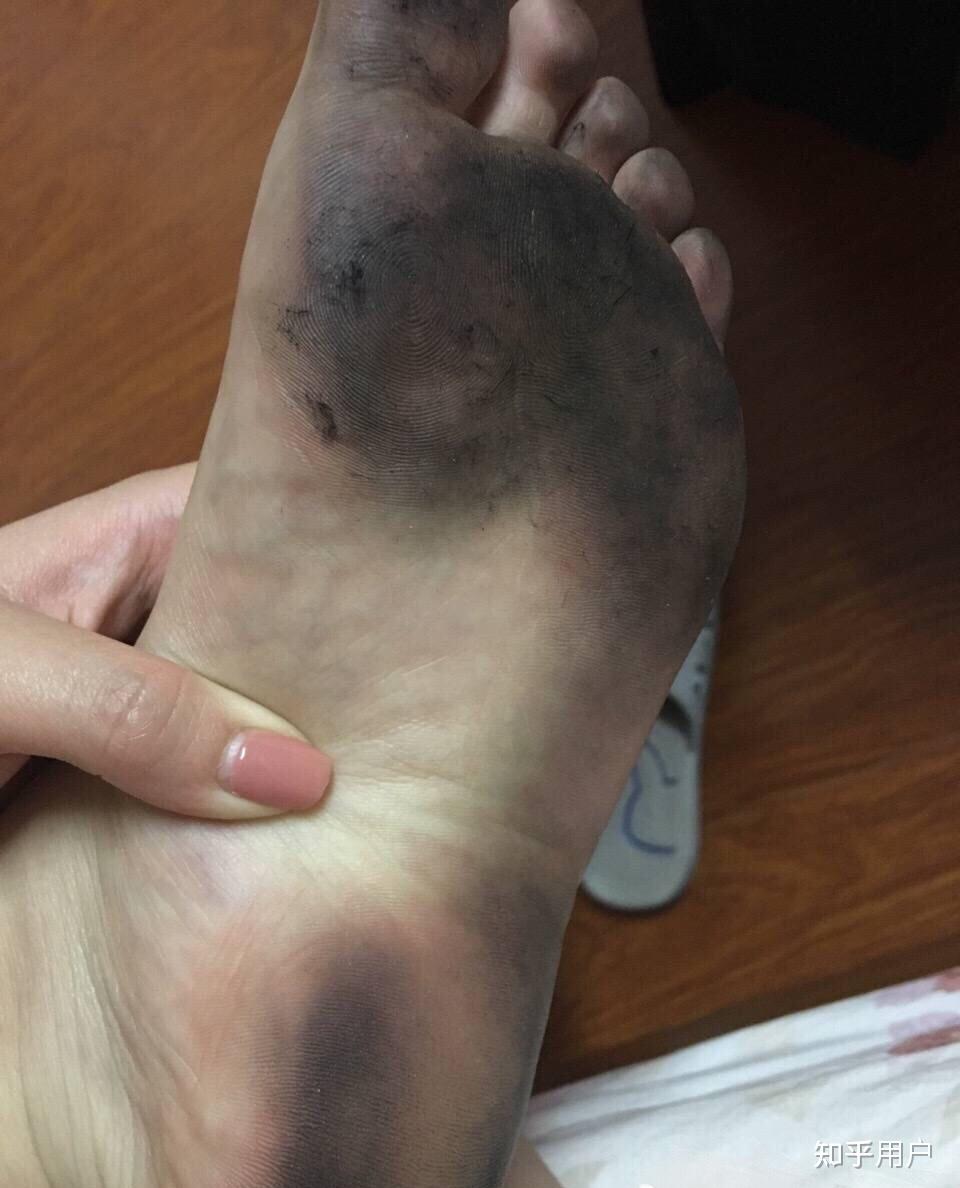 在家光脚走路到底好不好总觉得脚底粘了很多脏东西不能克服怎么办