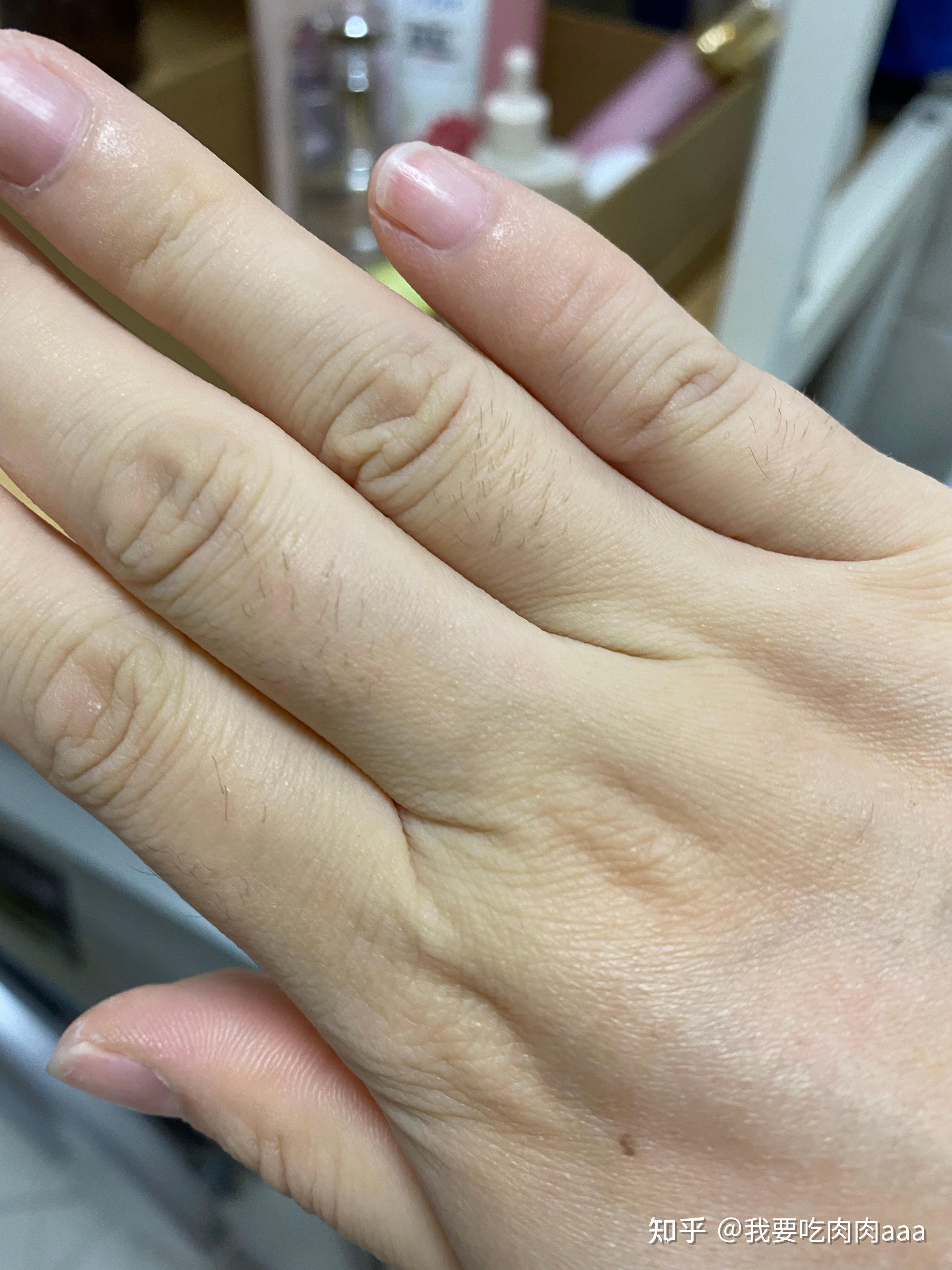 请问女生手毛会越刮越多,越刮越粗吗? - 知乎