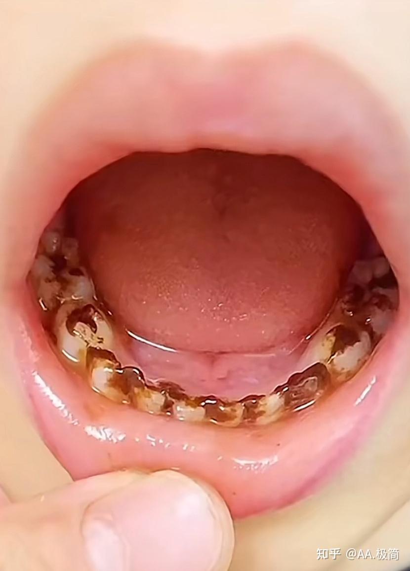 不爱刷牙的孩子,家长有哪些方法可以应对? - 知乎