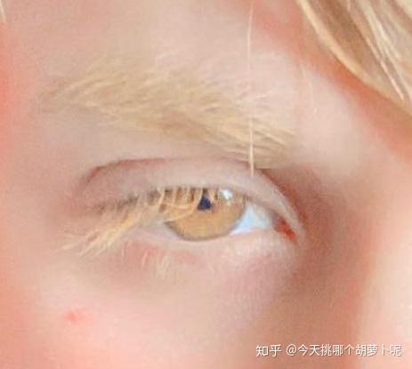 世界上是否有人类有金黄色眼睛? - 知乎