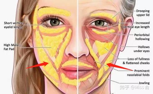 如何评价黄圣依的颜值