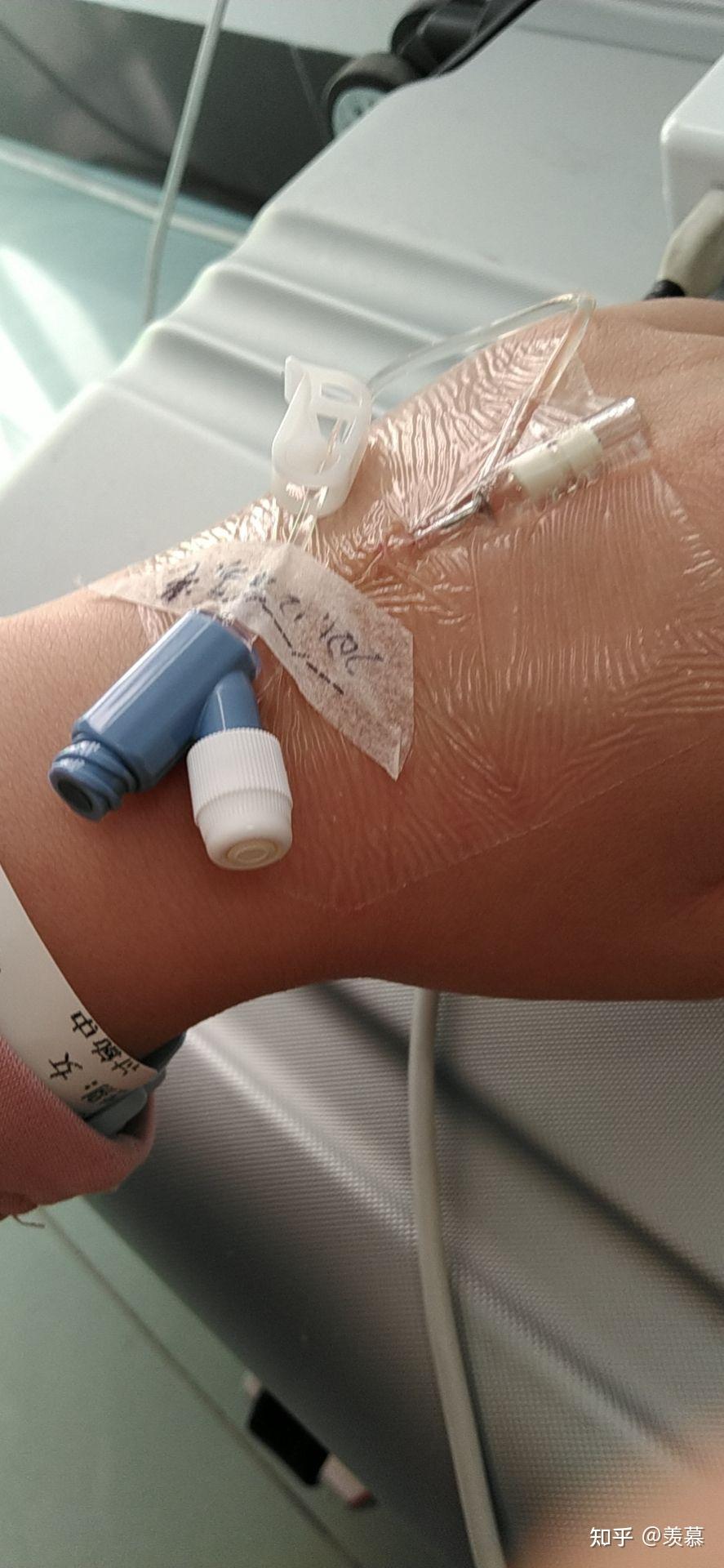 经历过mect的人现在都怎么样了