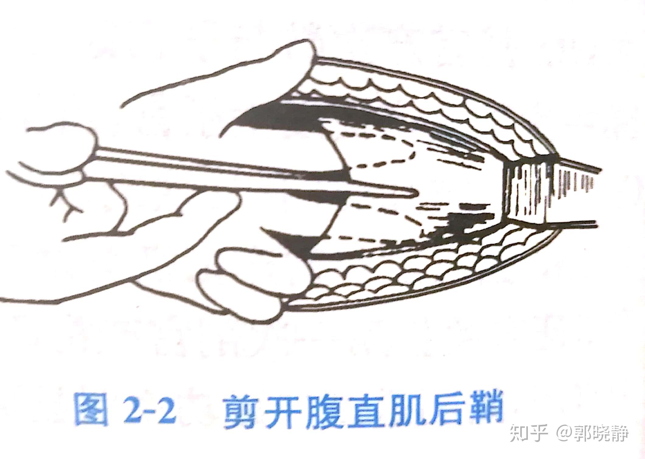 腹部手术伤口包扎图片, - 伤感说说吧