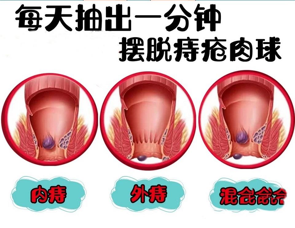 肛门长肉球了怎么办? - 知乎