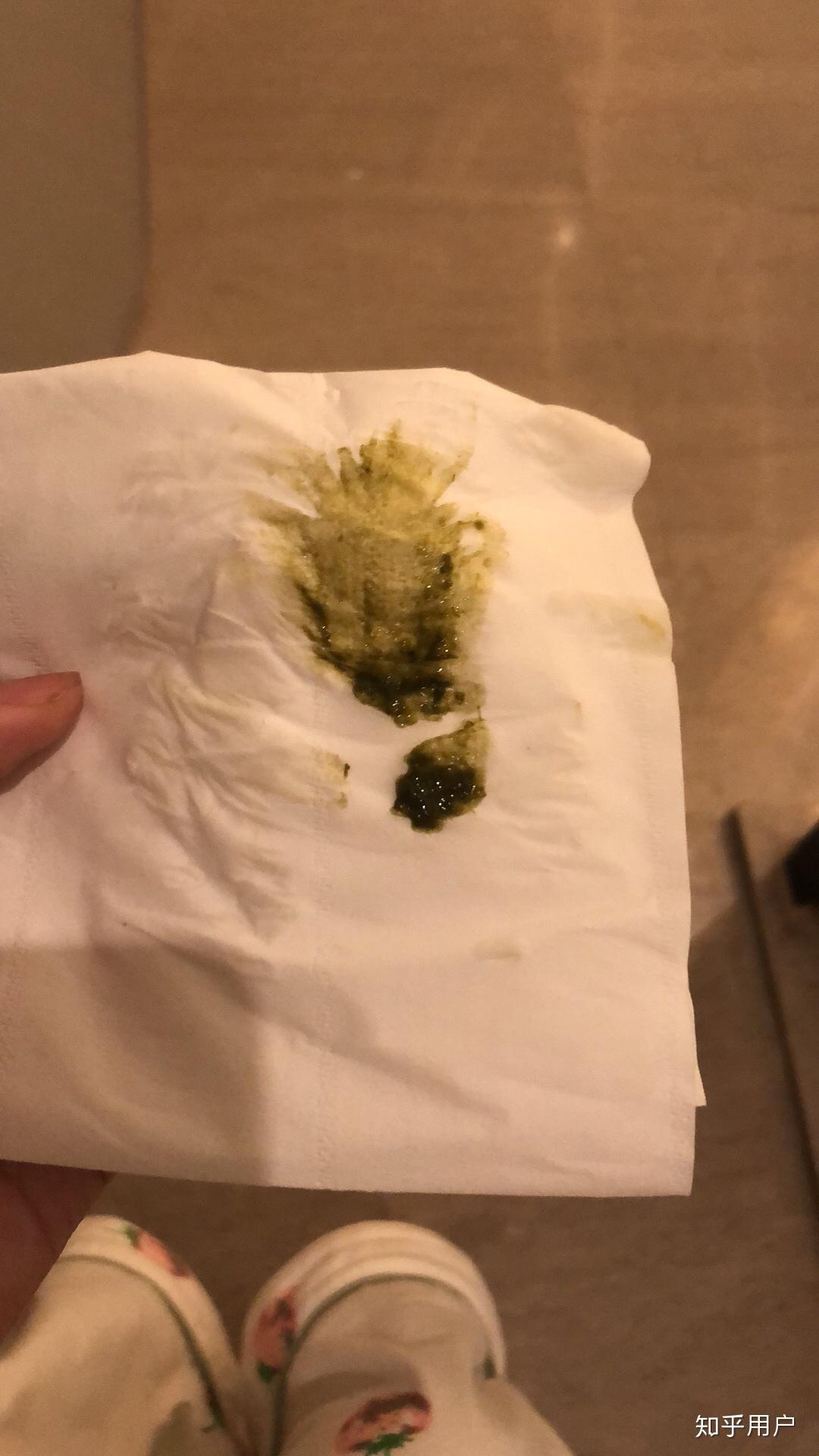 拉屎绿色 知乎