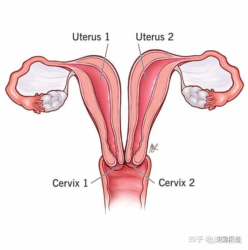 双子宫位置图片图片