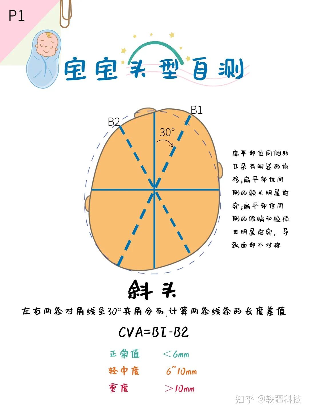本能能稍微缓解一下扁头斜头舟状头焦虑 - 知乎