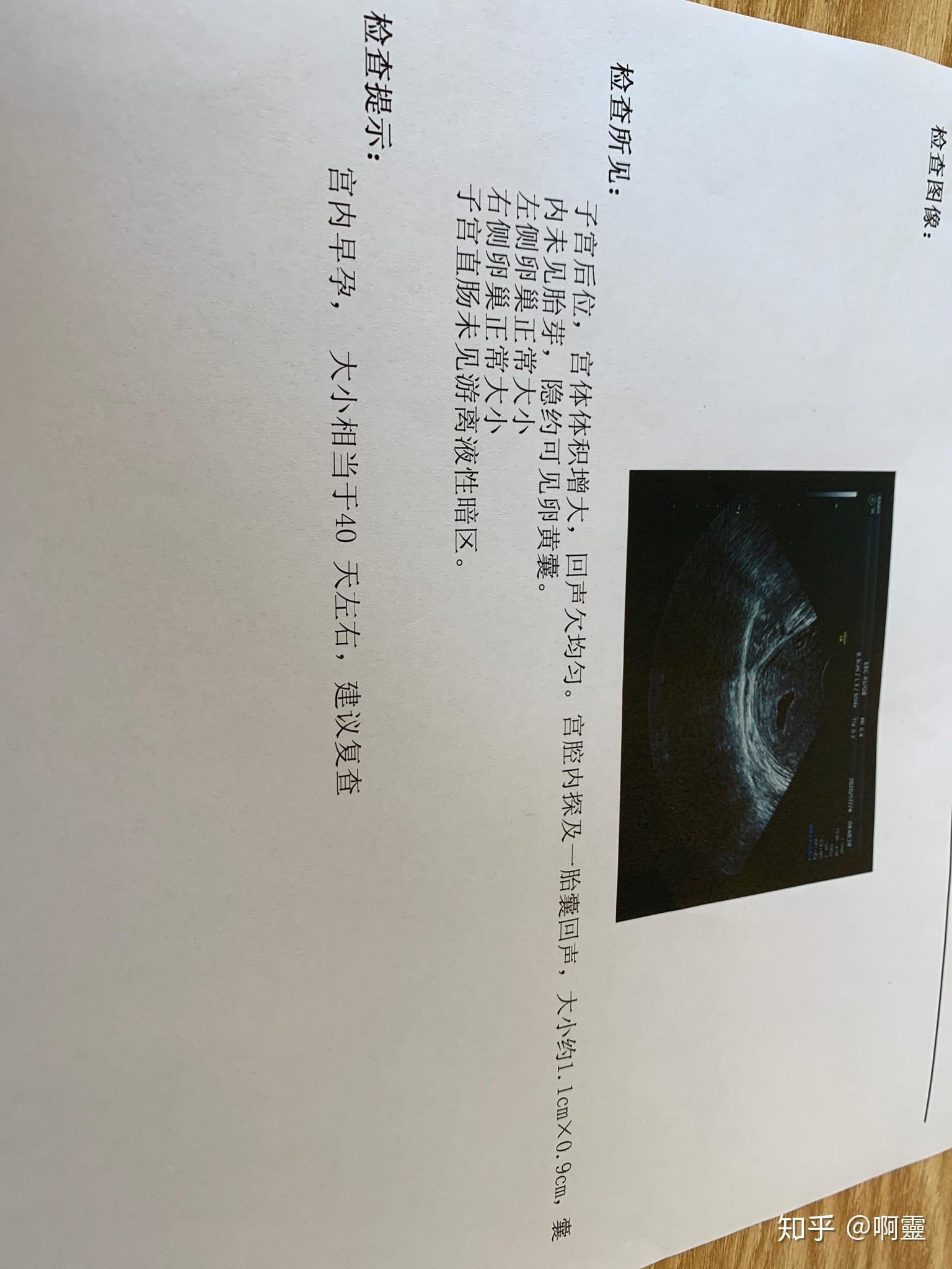 怀孕40天左右阴道彩超提示宫内探及一胎囊回声隐约可