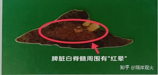 猪丹毒病变报告 - 知乎