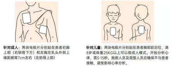 为什么aed的电极片必须贴在左胸下,右胸上? - 知乎