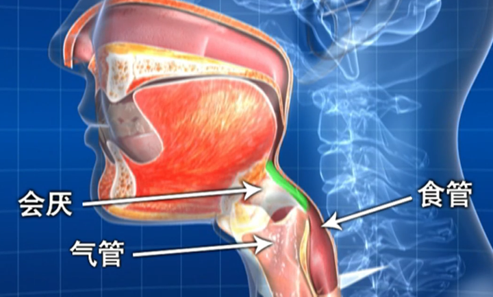 家里老人呛咳不能忽视！不要等到引发吸入性肺炎才后悔 - 知乎