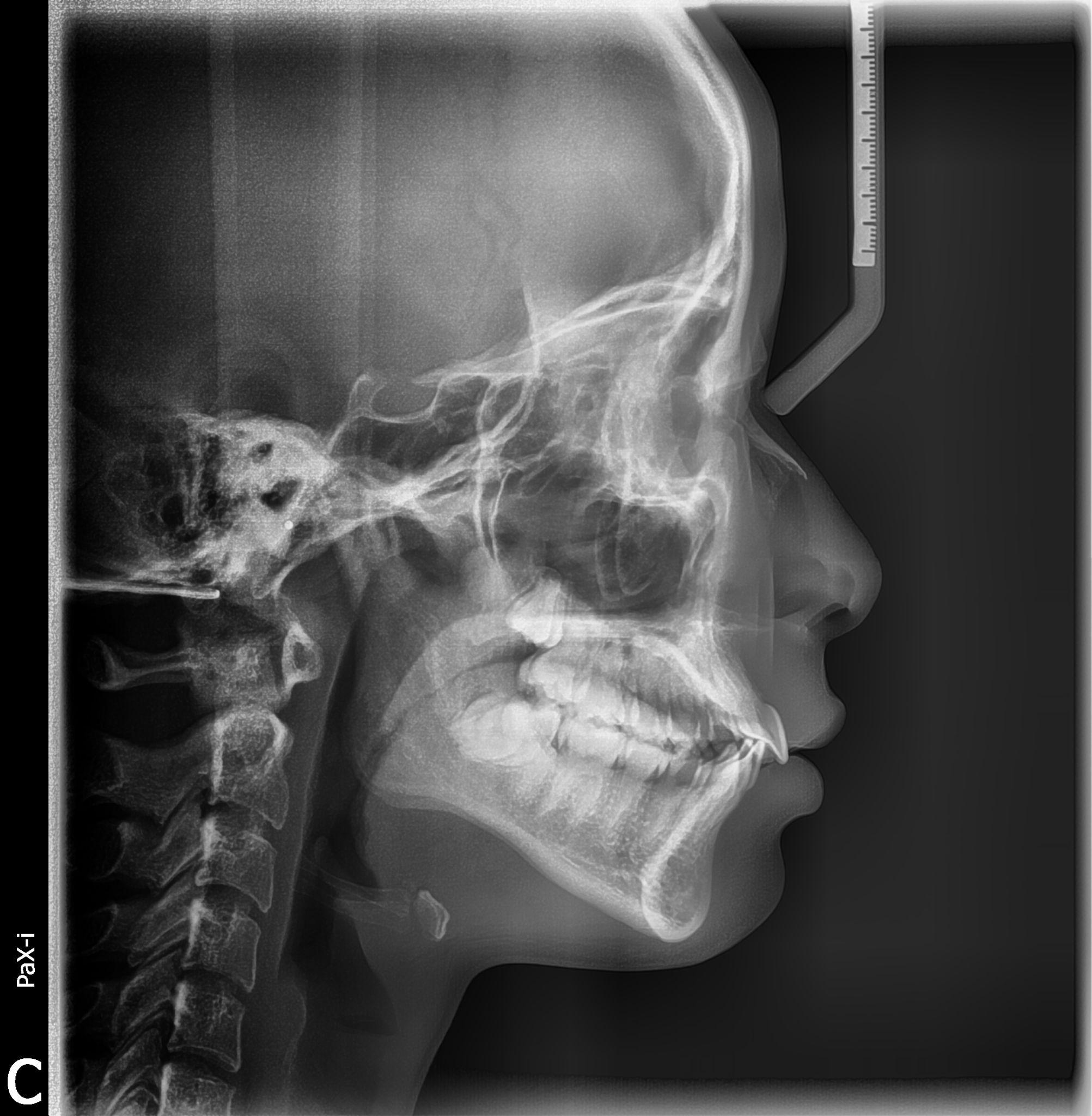 北京大学口腔医院挂号CT加急-北京大学口腔医院现场挂号好挂吗 