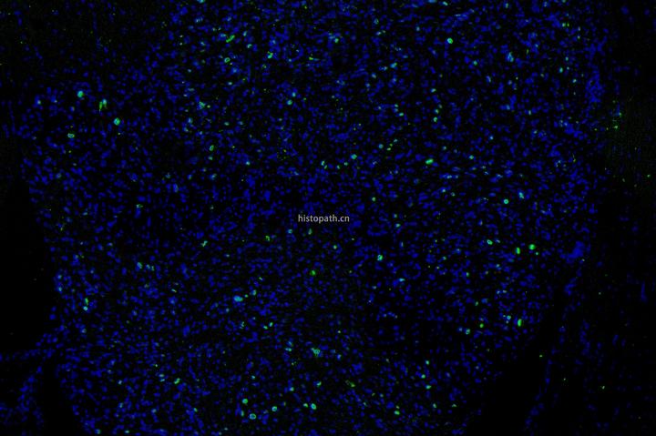 免疫荧光（多重免疫荧光）实验操作步骤 - 知乎