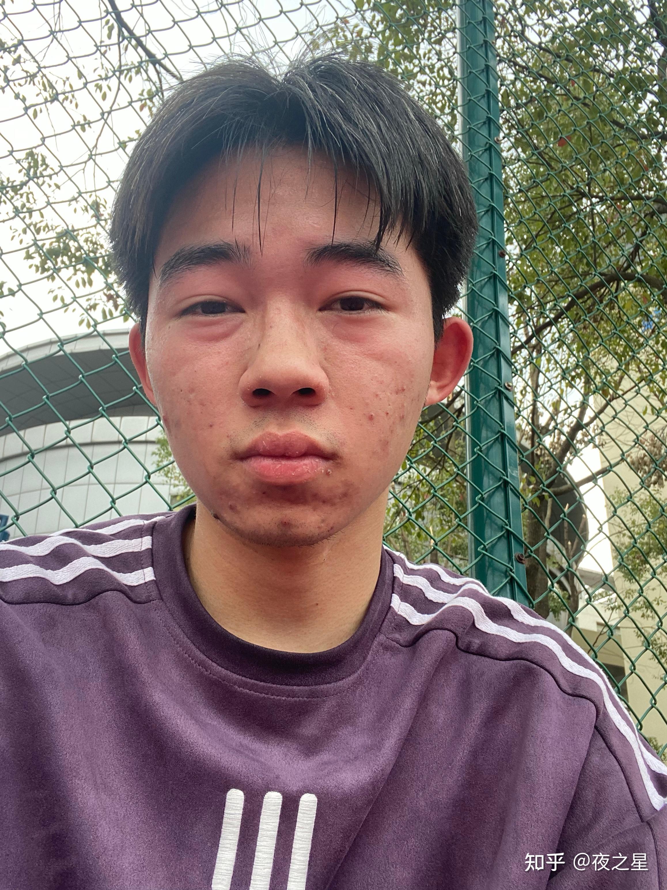 有没有长得丑的男生照片分享一下我想知道什么样算丑