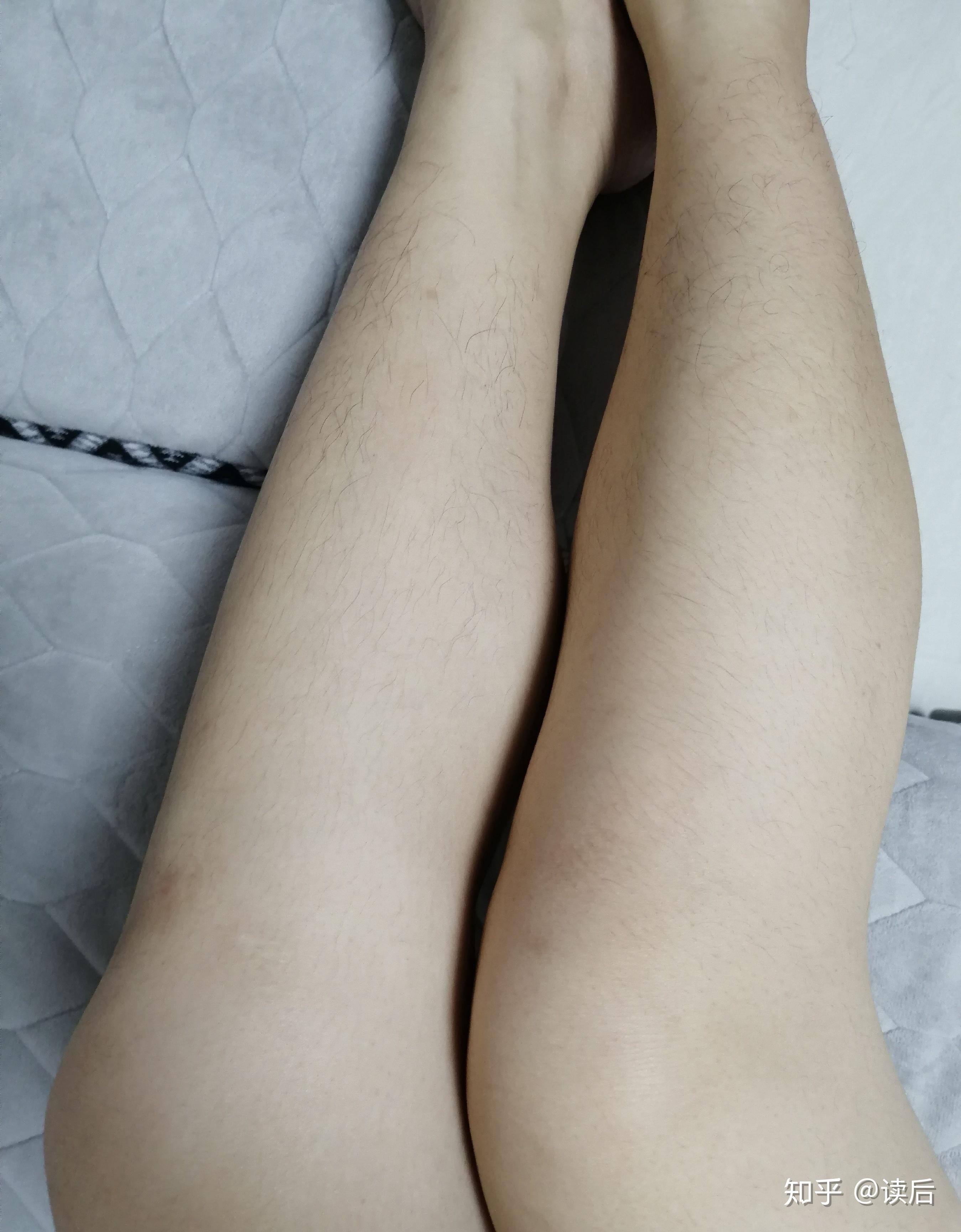 腿毛真的会越刮越多吗? - 知乎