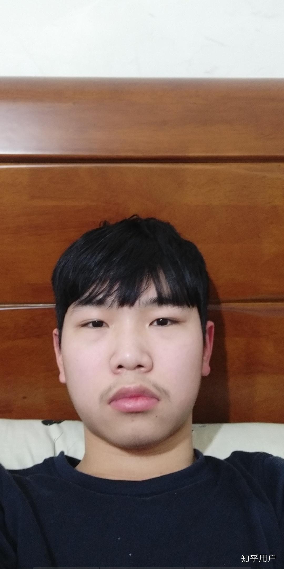 有没有人是一边脸大一边脸小