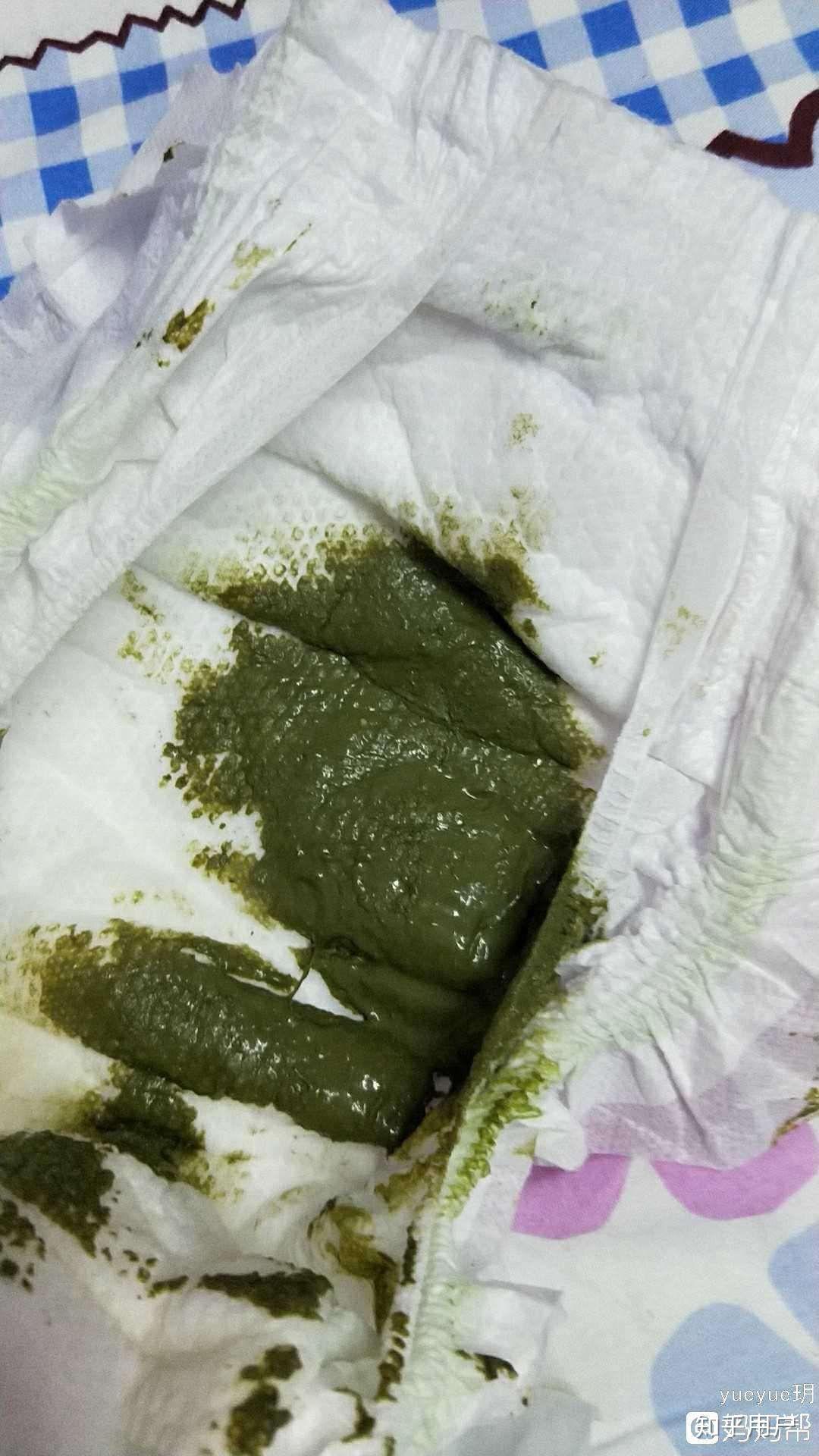 为什么会拉绿色的屎