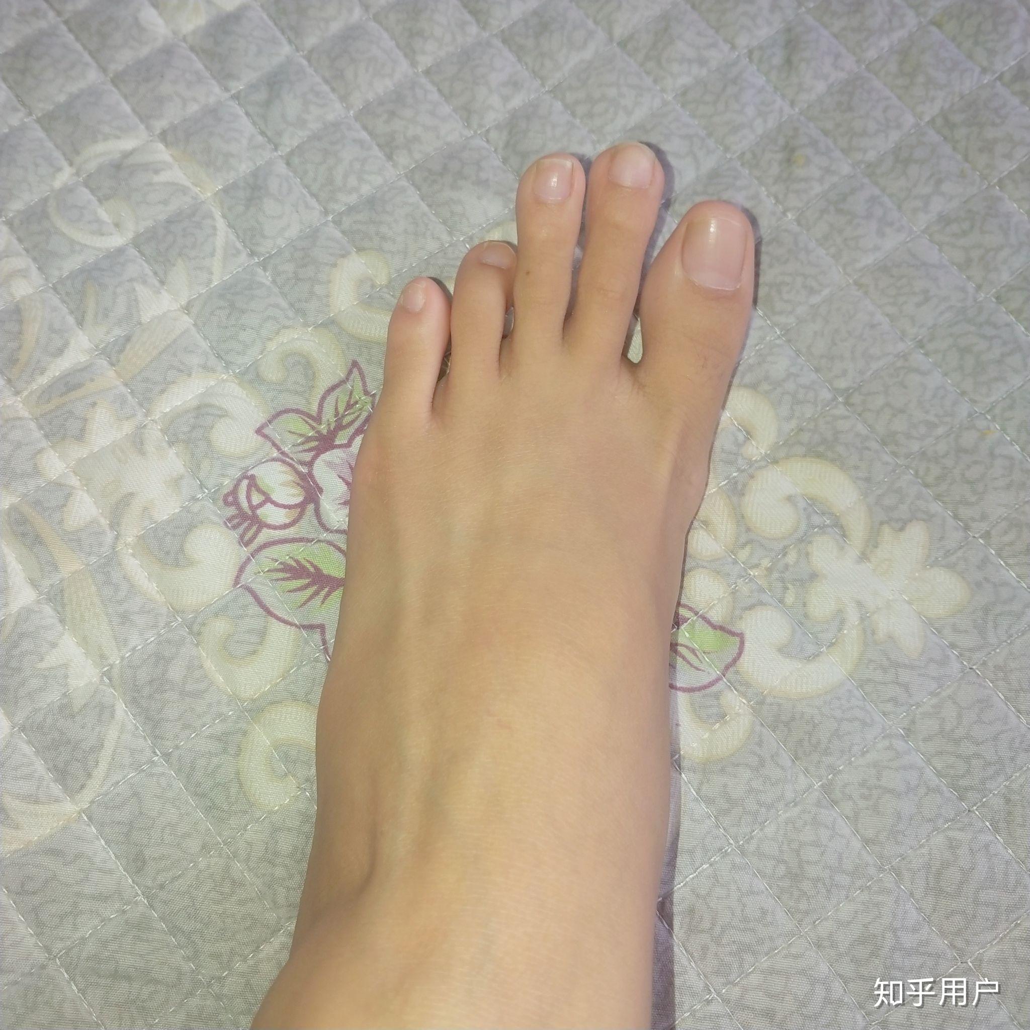 女生有一双很丑的脚有什么体验?