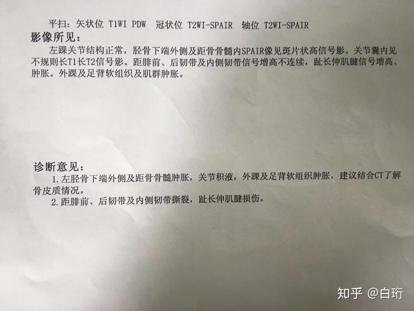 脚崴了伤到筋,4个月都没好?