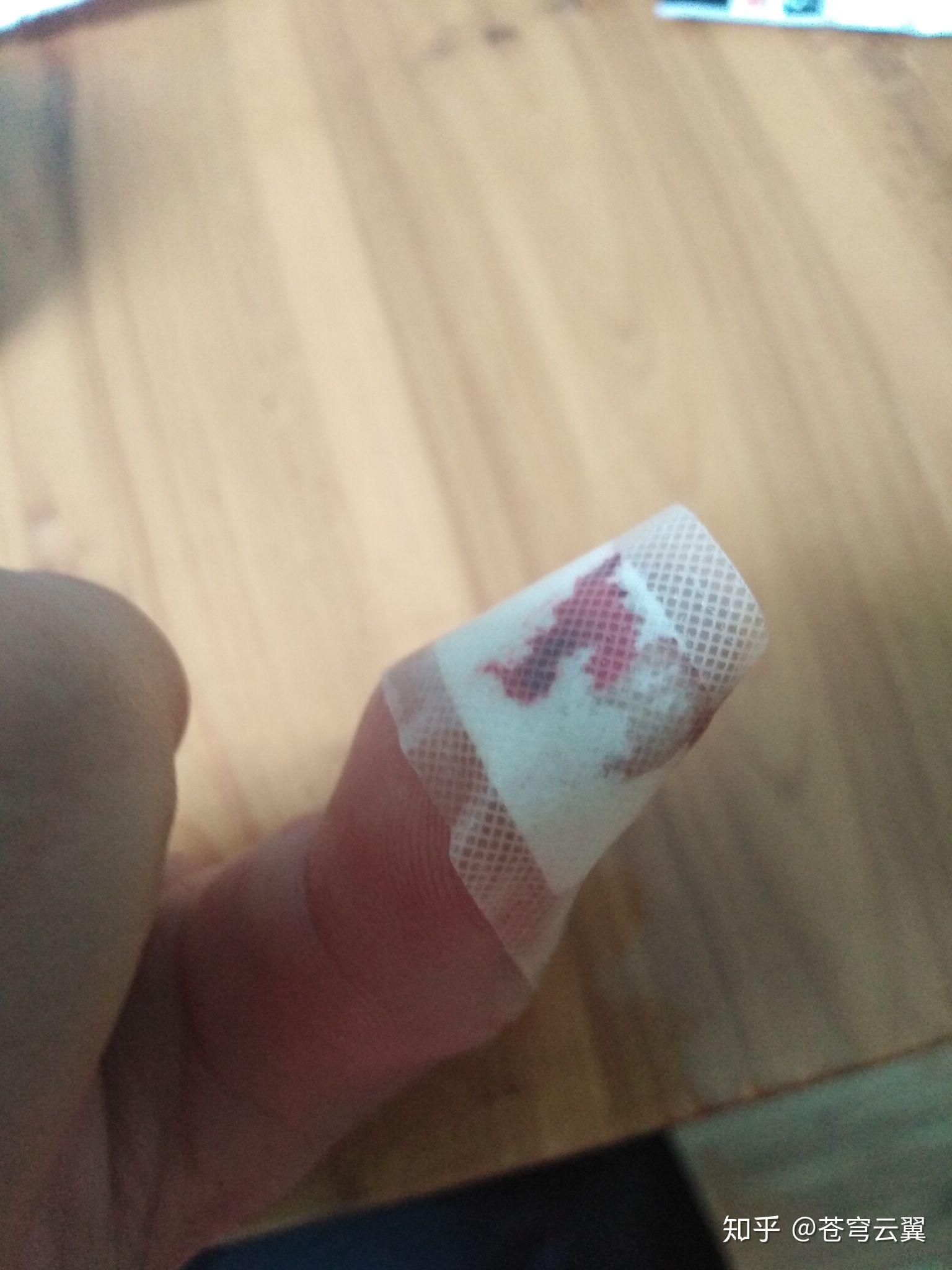 切菜时切到手是一种什么样的体验