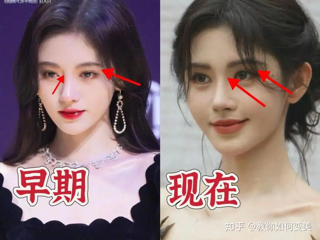 小鞠又换新脸了，像张予曦、王子文，就是不像自己 ~ - 知乎