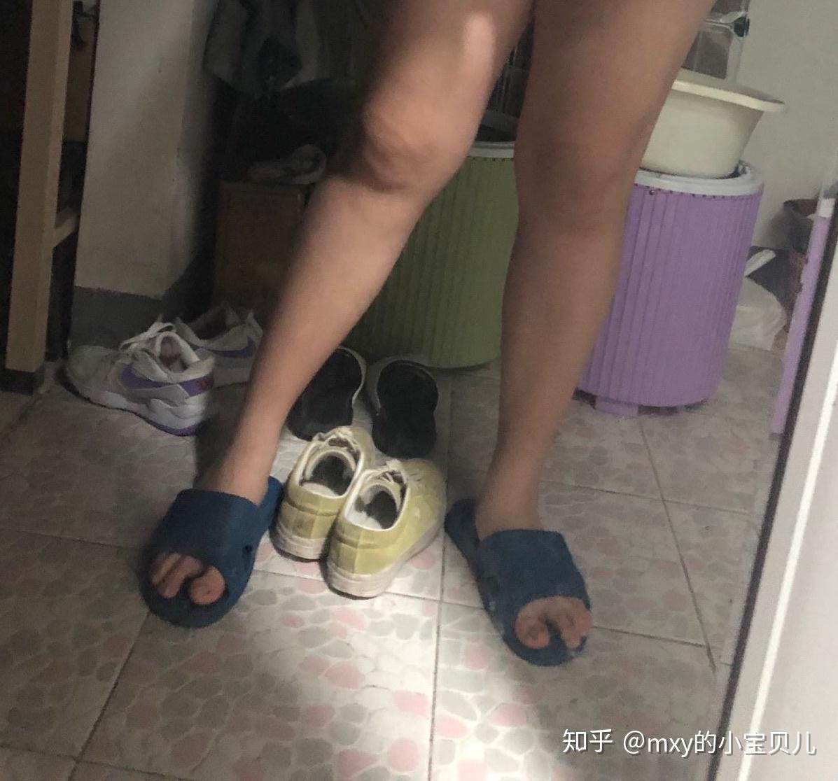 脚踝太细怎么办