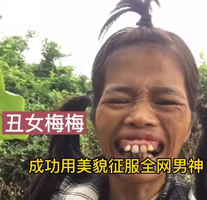 广东女子因长相奇特成大网红一口龅牙无处安放网友抢着要娶她