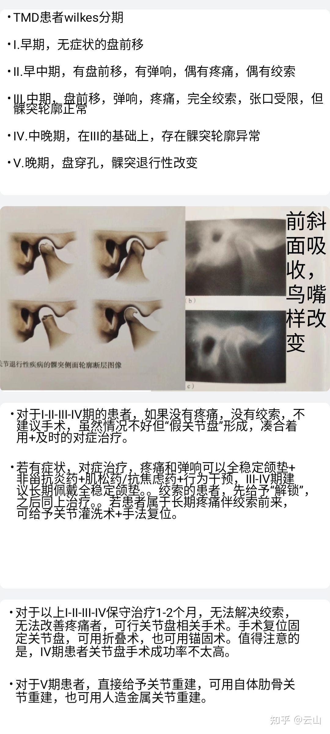 颞下颌关节盘不可复性盘前移位,什么情况下需要做手术呢?