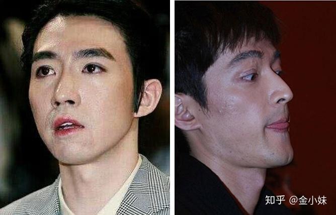 你为什么想整容