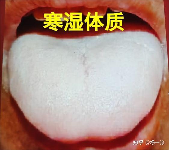 今天给大家分享:寒湿、痰湿、湿热,到底该如何区分 - 知乎