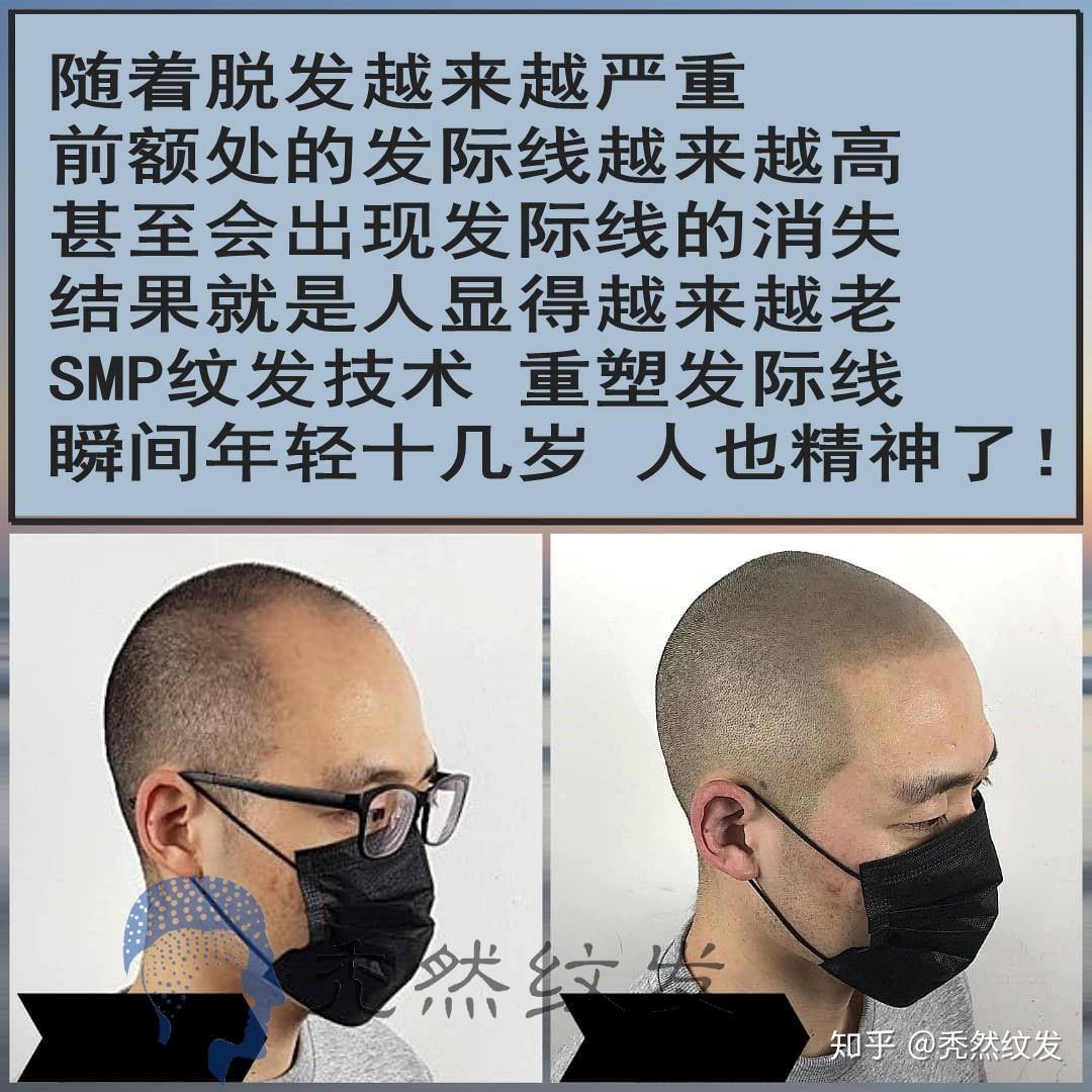 什么是纹发？ - 知乎