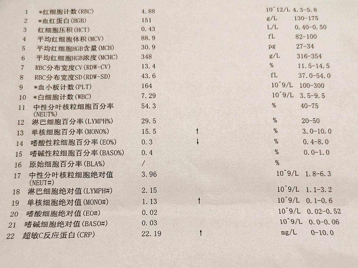 姑娘喉咙疼患急性会厌炎从就诊到去世仅十分钟什么是急性会厌炎哪些