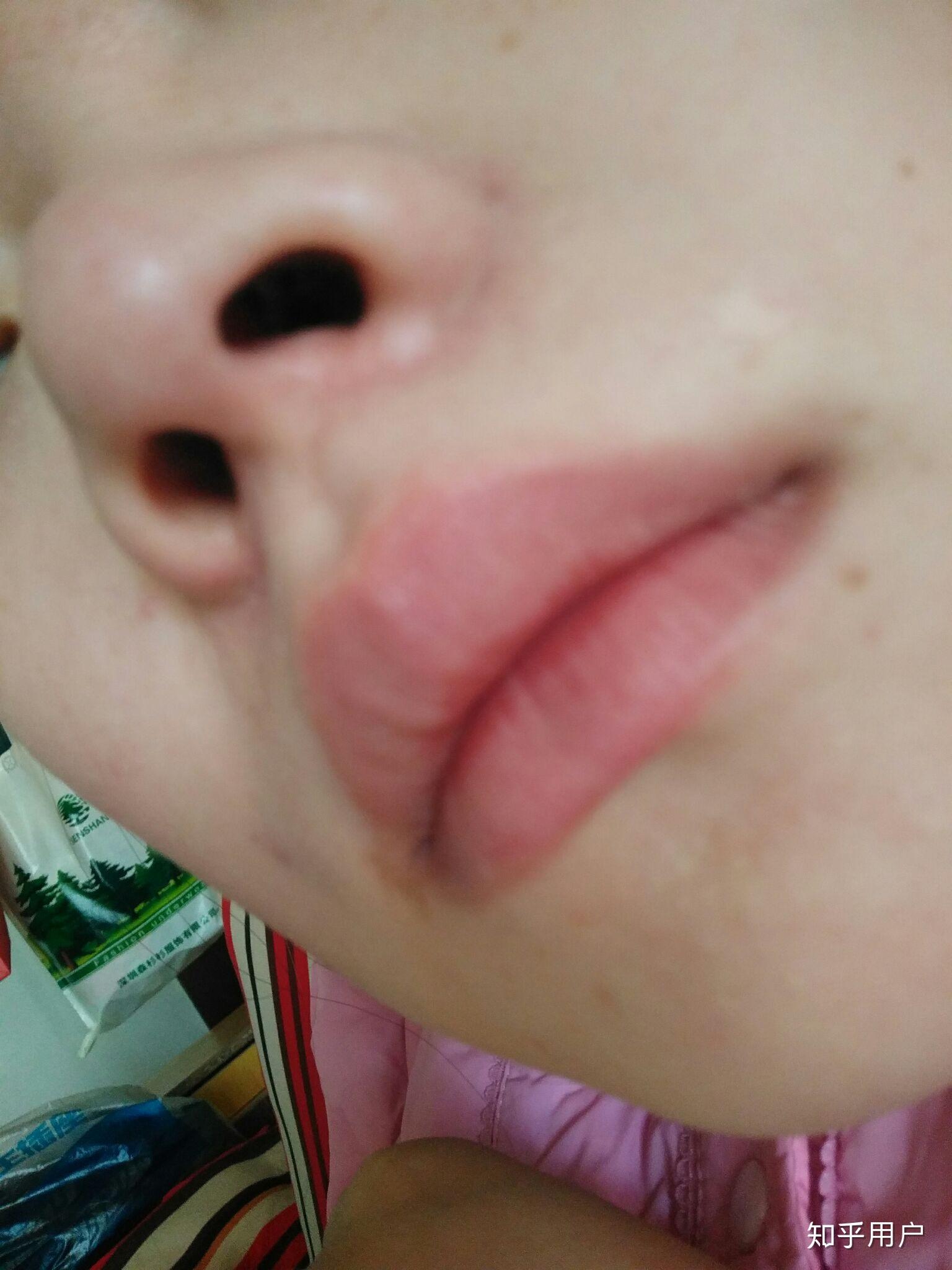 女朋友鼻孔太大是什么体验