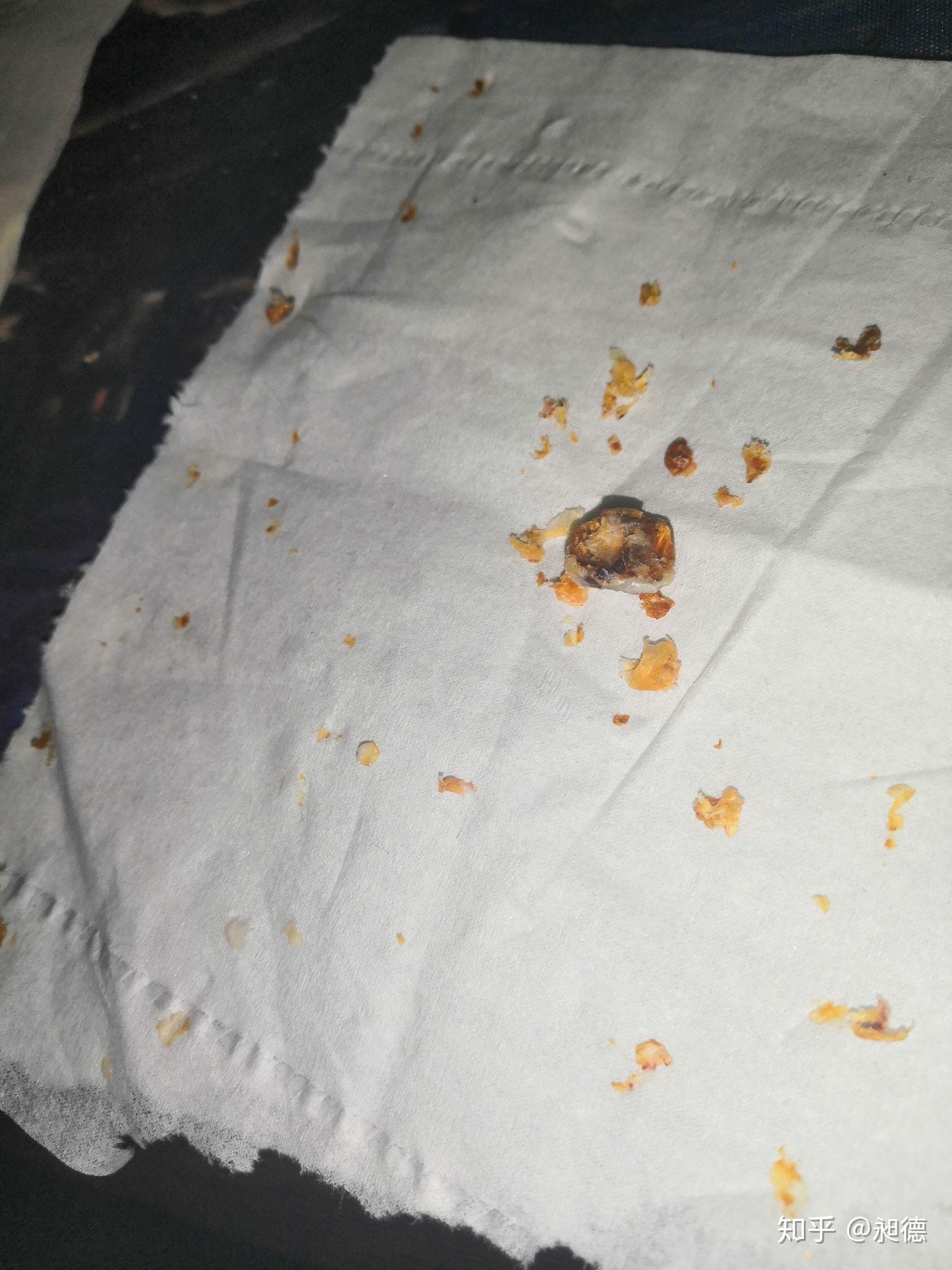 耳屎能大到什么程度? - 知乎