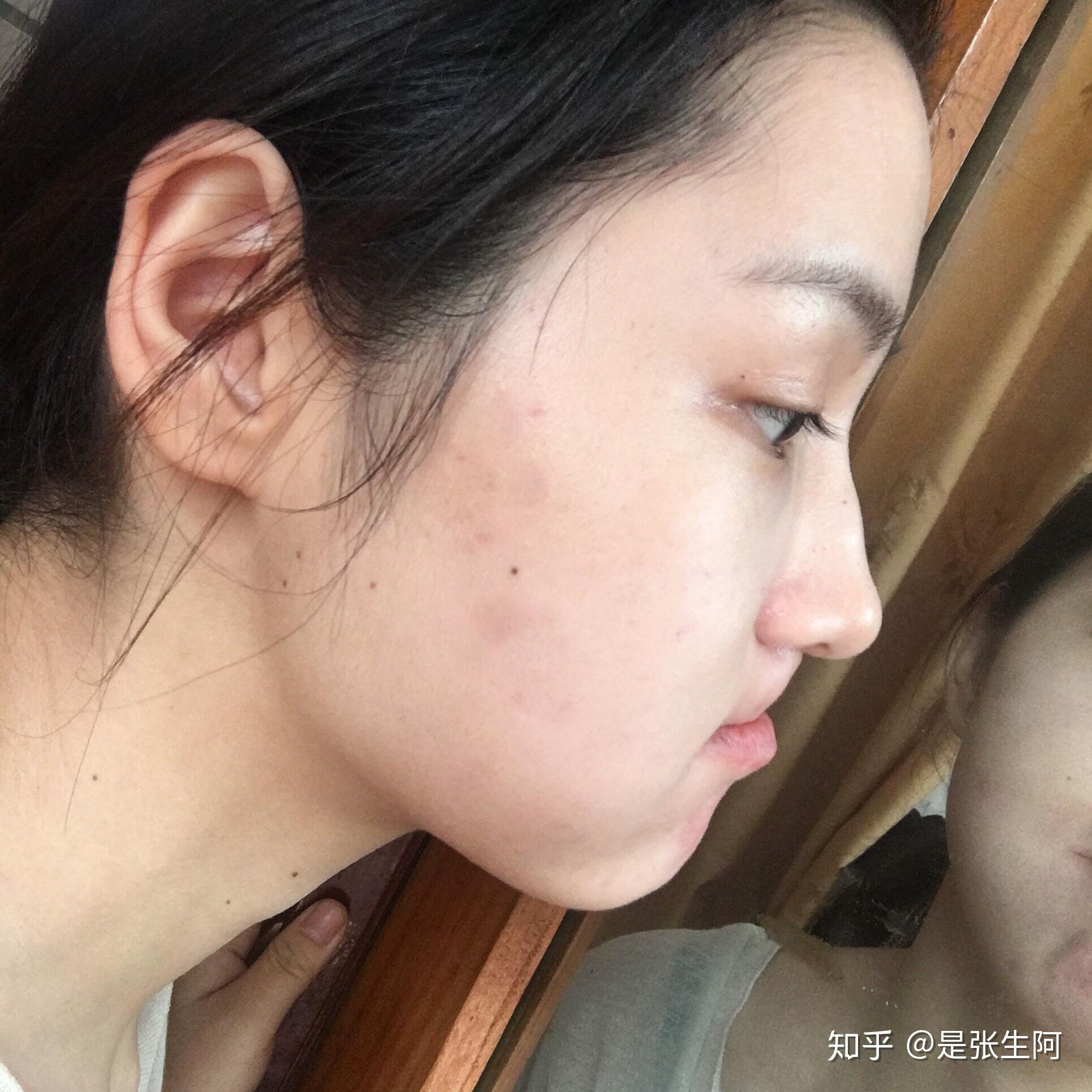 有没有鼻尖不翘或者驼峰鼻或者鼻梁不高,鼻子依然漂亮的例子? - 知乎