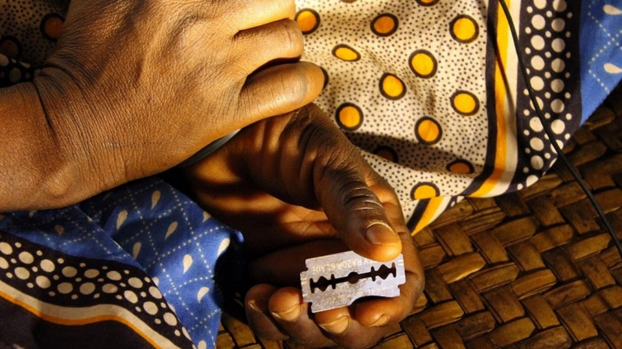 资料图:割礼中使用的工具,通常没有任何消毒措施