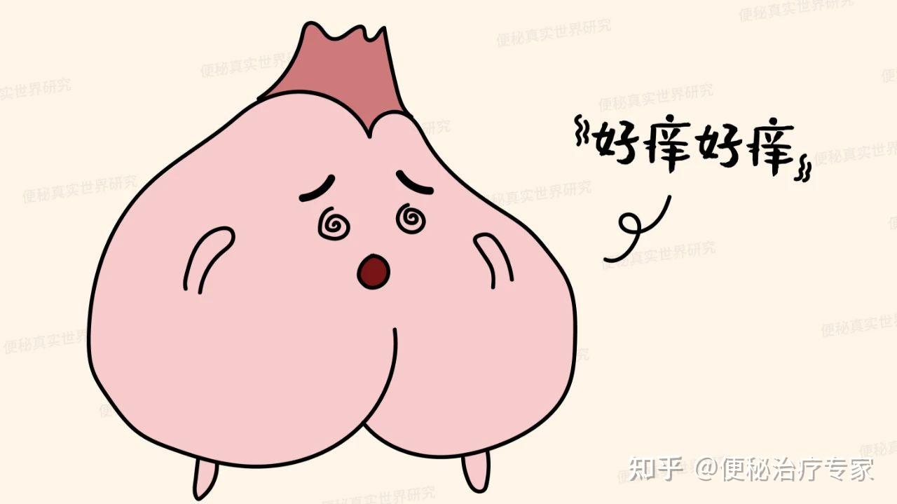 肛门痒是痔疮吗如何判断痔疮的初期症状