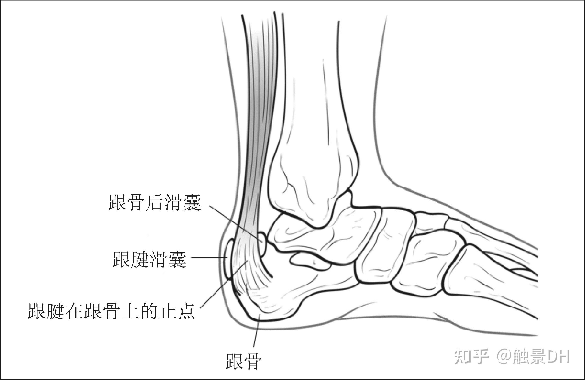 脚后跟结构图片