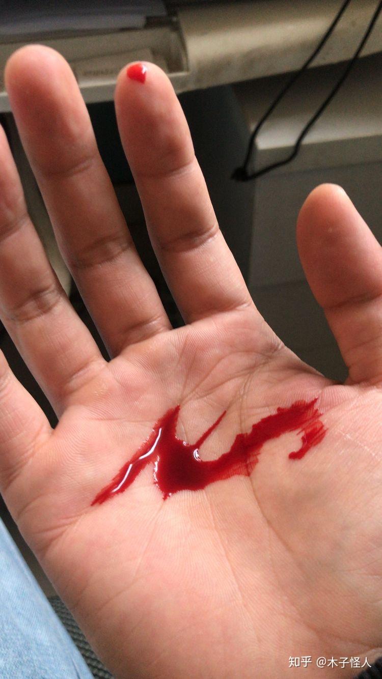 用手握住刀刃在手掌上划一刀会留下疤吗. - 知乎
