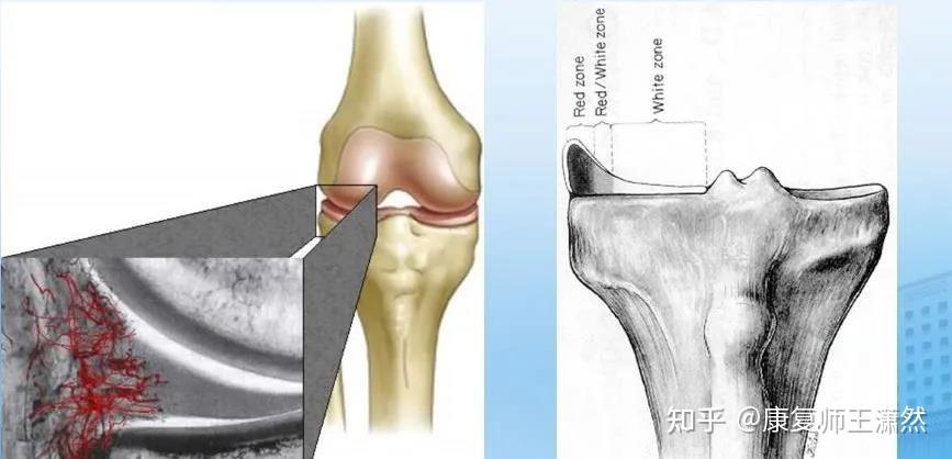 半月板外侧前角血运多么? - 知乎