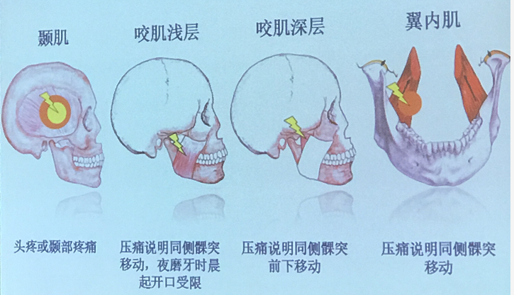 牵一发而动全身--神奇的人体姿态肌链 - 知乎
