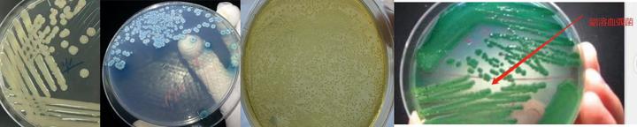 绿弧菌和黄弧菌:虾类养殖的双重挑战与防控策略