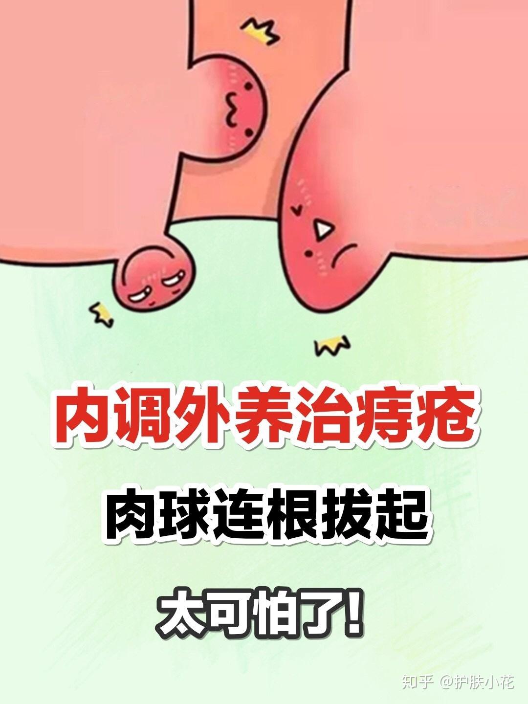 治疗痔疮的有效办法有哪些
