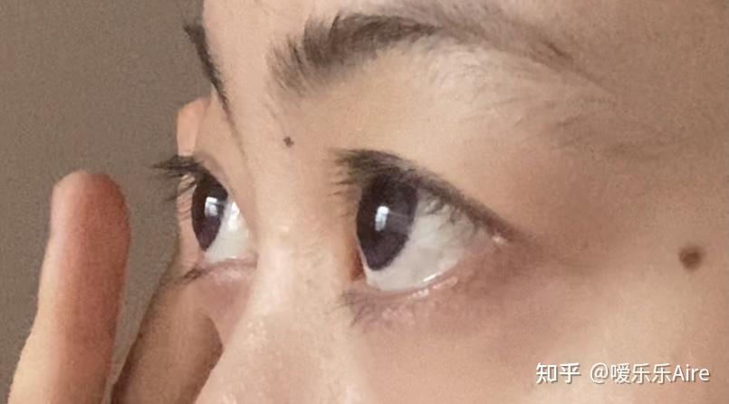 这算眼球突出吗? - 知乎