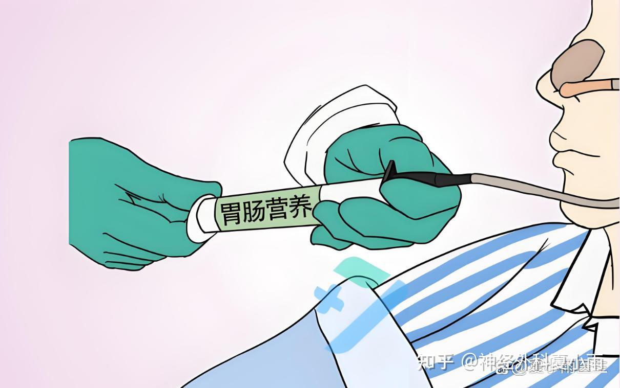 为避免误吸导致肺部感染，鼻饲时有何注意事项？ - 知乎