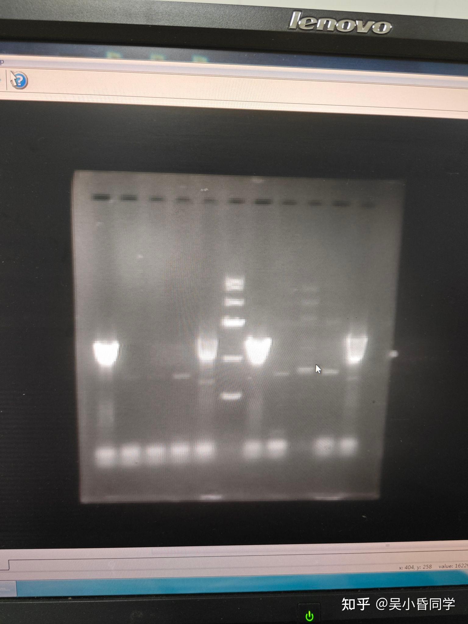PCR扩增cDNA,条带弥散,求原因? - 知乎